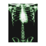 X-RAY SKELETON TORSO RIBS GREEN POST CARD