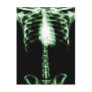 X-RAY SKELETON TORSO RIBS GREEN POST CARD