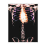 X-RAY SKELETON TORSO RIBS ORIGINAL POSTCARDS