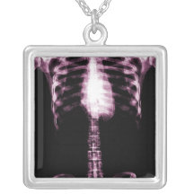 X-RAY SKELETON TORSO RIBS - PINK PENDANT