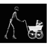 X-RAY SKELETON WOMAN & BABY CARRIAGE - B&W photo sculptures