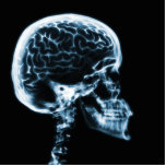 X-RAY SKULL BRAIN - BLUE photo sculptures