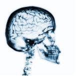 X-RAY SKULL BRAIN - BLUE photo sculptures