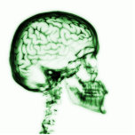 X-RAY SKULL BRAIN - GREEN photo sculptures