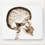 X-RAY SKULL BRAIN - ORANGE mousepads