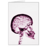 X-RAY SKULL BRAIN - PINK CARDS