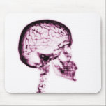 X-RAY SKULL BRAIN - PINK mousepads