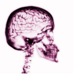 X-RAY SKULL BRAIN - PINK photo sculptures