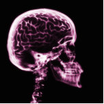 X-RAY SKULL BRAIN - PINK photo sculptures
