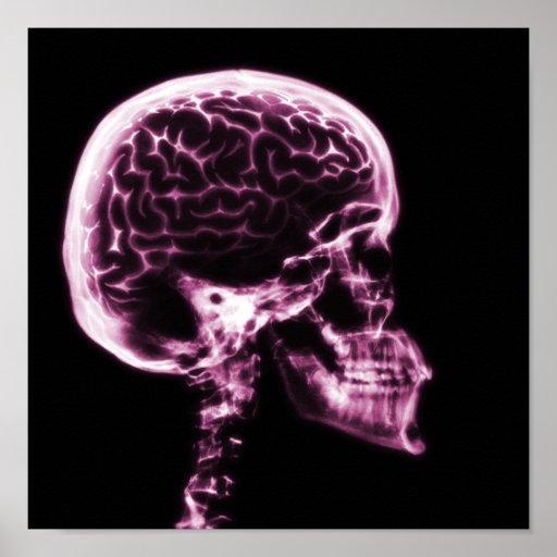 X-RAY SKULL BRAIN - PINK PRINT