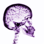 X-RAY SKULL BRAIN - PURPLE photo sculptures