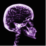 X-RAY SKULL BRAIN - PURPLE photo sculptures