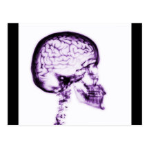X-RAY SKULL BRAIN - PURPLE POSTCARDS