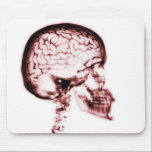 X-RAY SKULL BRAIN - RED mousepads
