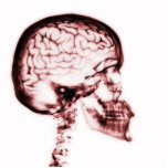 X-RAY SKULL BRAIN - RED photo sculptures