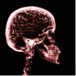 X-RAY SKULL BRAIN - RED photo sculptures