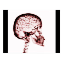 X-RAY SKULL BRAIN - RED POST CARDS