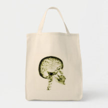 X-RAY SKULL BRAIN - YELLOW CANVAS BAG