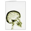 X-RAY SKULL BRAIN - YELLOW cards