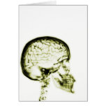 X-RAY SKULL BRAIN - YELLOW cards