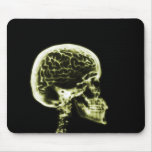 X-RAY SKULL BRAIN - YELLOW mousepads