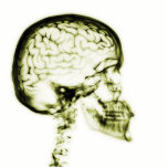 X-RAY SKULL BRAIN - YELLOW photo sculptures