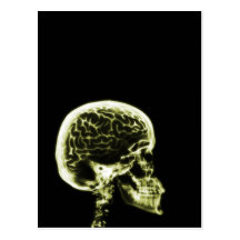X-RAY SKULL BRAIN - YELLOW POST CARDS