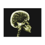X-RAY SKULL BRAIN - YELLOW postcards