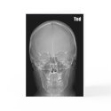 X-ray Ted Birthday Card