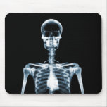 X-Ray Vision Blue Single Skeleton