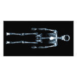 X-Ray Vision Blue Single Skeleton photo cards