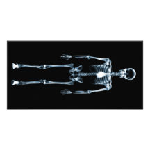 X-Ray Vision Blue Single Skeleton Photo Card Template