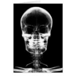 X-RAY VISION SKELETON SKULL - B&W cards
