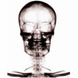 X-RAY VISION SKELETON SKULL - ORIGINAL photo sculptures
