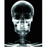 X-RAY VISION SKELETON SKULL - ORIGINAL photo sculptures