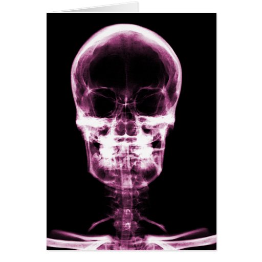 X-RAY VISION SKELETON SKULL - PINK CARDS