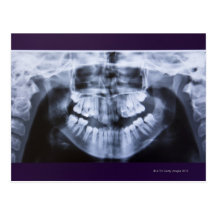 Xray of a girls jawline taken with a panoramic post card