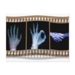 XRAY SIGN LANGUAGE FILM - HAND OK HANDSHAKE postcards