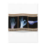 XRAY SIGN LANGUAGE FILM - HAND OK HANDSHAKE postcards