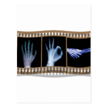 XRAY SIGN LANGUAGE FILM - HAND OK HANDSHAKE POSTCARDS