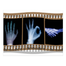 XRAY SIGN LANGUAGE FILM - HAND OK HANDSHAKE POSTCARDS