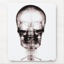 XRAY SKELETON SKULL ORIGINAL NEGATIVE MOUSE MATS