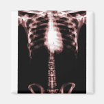 XRAY SKELETON TORSO RIBS RED FRIDGE MAGNET