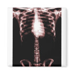 XRAY SKELETON TORSO RIBS RED magnets