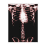 XRAY SKELETON TORSO RIBS RED postcards