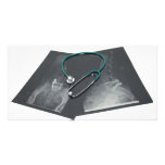 XRayConsult061209 photo cards