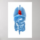 Search for bowel posters Detail