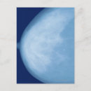 Search for nipples postcards Vertical