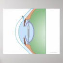 Search for surgery posters Medical