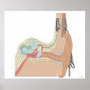 Search for implants posters Medical